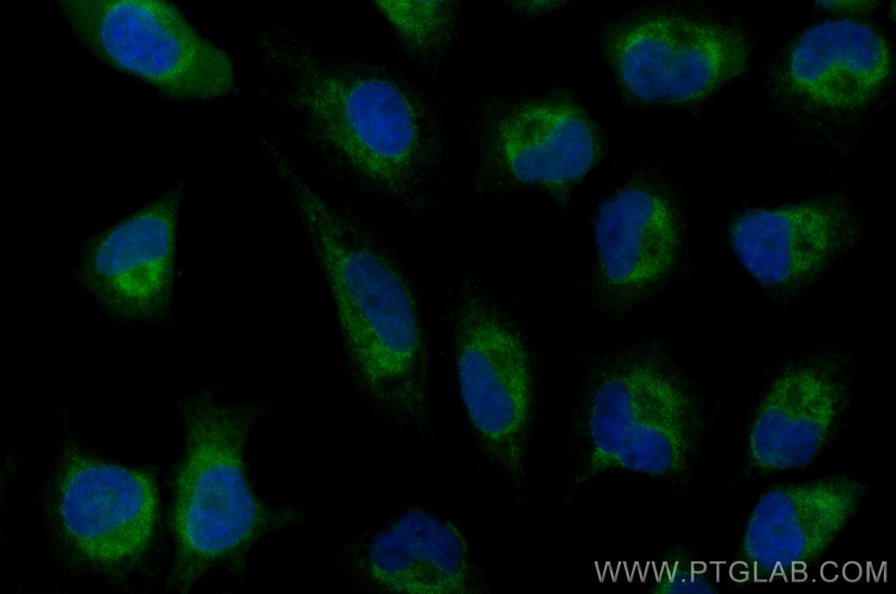 Immunofluorescence (IF) / fluorescent staining of HeLa cells using CoraLite® Plus 488-conjugated DRP1 (C-terminal) Po (CL488-12957)