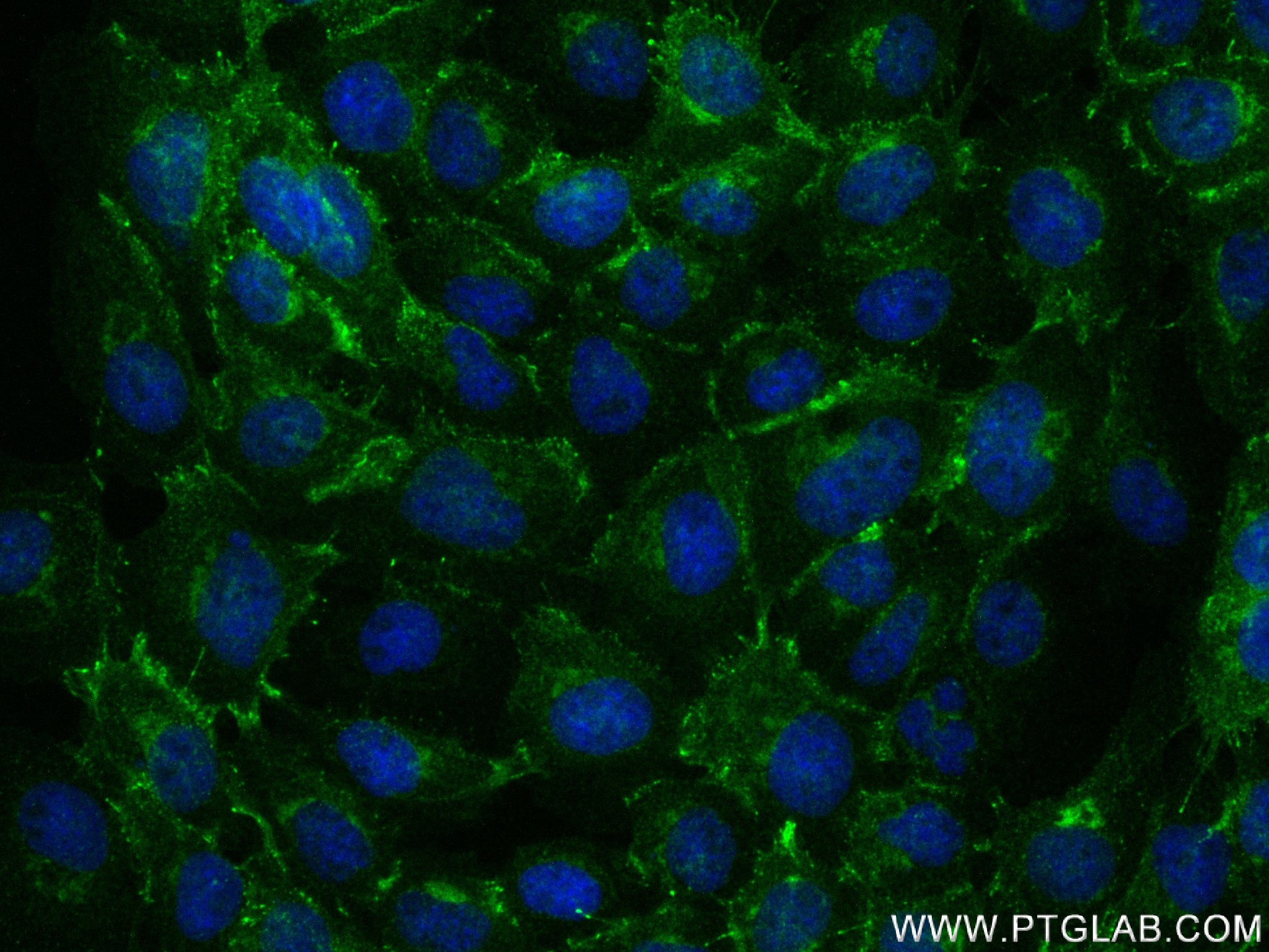 Immunofluorescence (IF) / fluorescent staining of A431 cells using DSC3 Recombinant antibody (83386-5-RR)