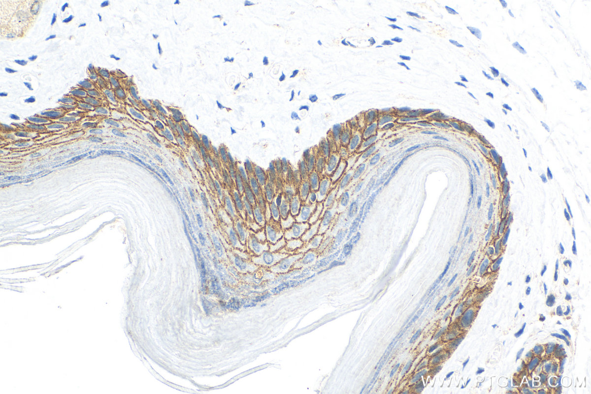 Immunohistochemistry (IHC) staining of mouse skin tissue using DSC3 Recombinant antibody (83386-5-RR)