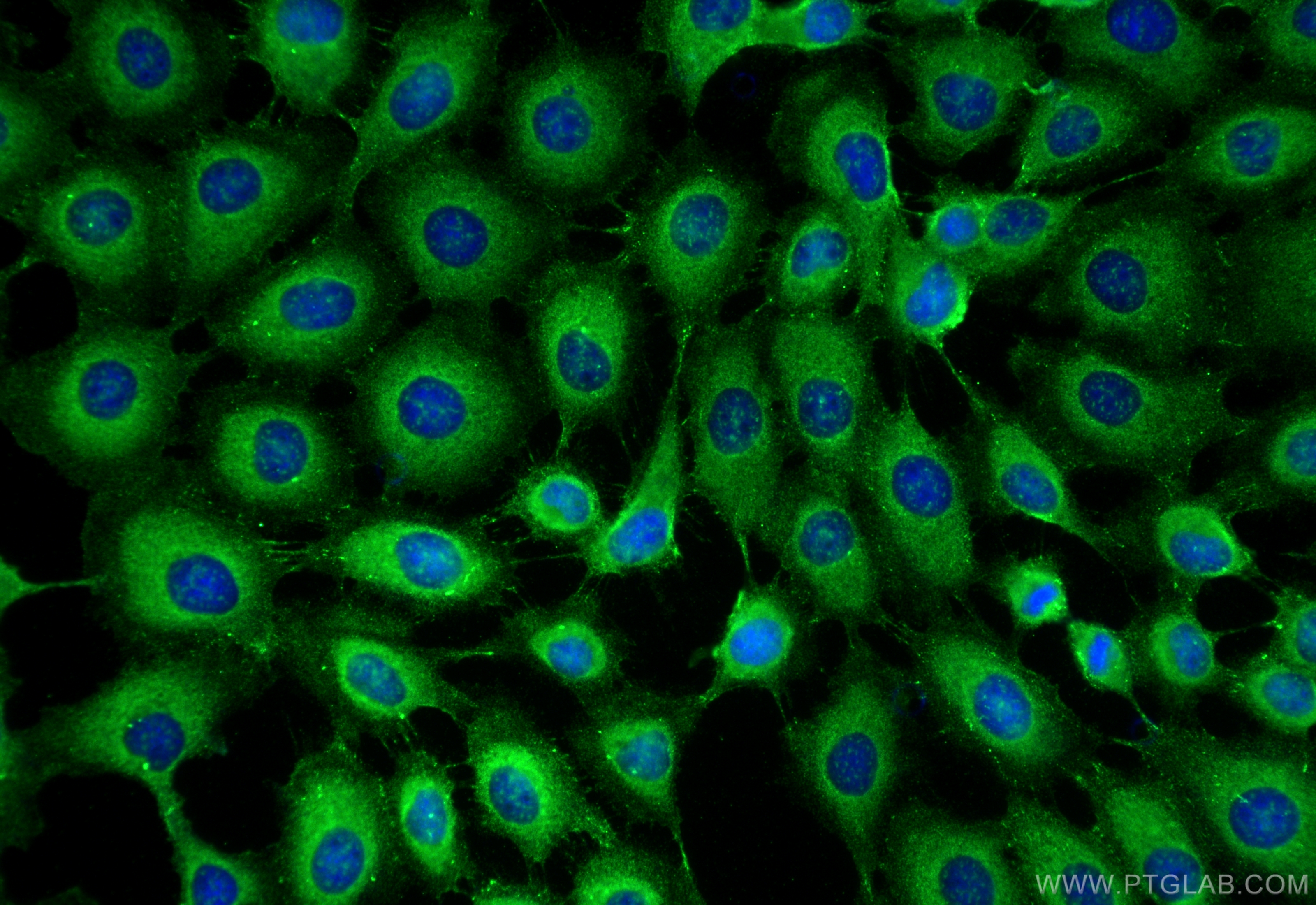 Immunofluorescence (IF) / fluorescent staining of A431 cells using DSG1 Polyclonal antibody (24587-1-AP)