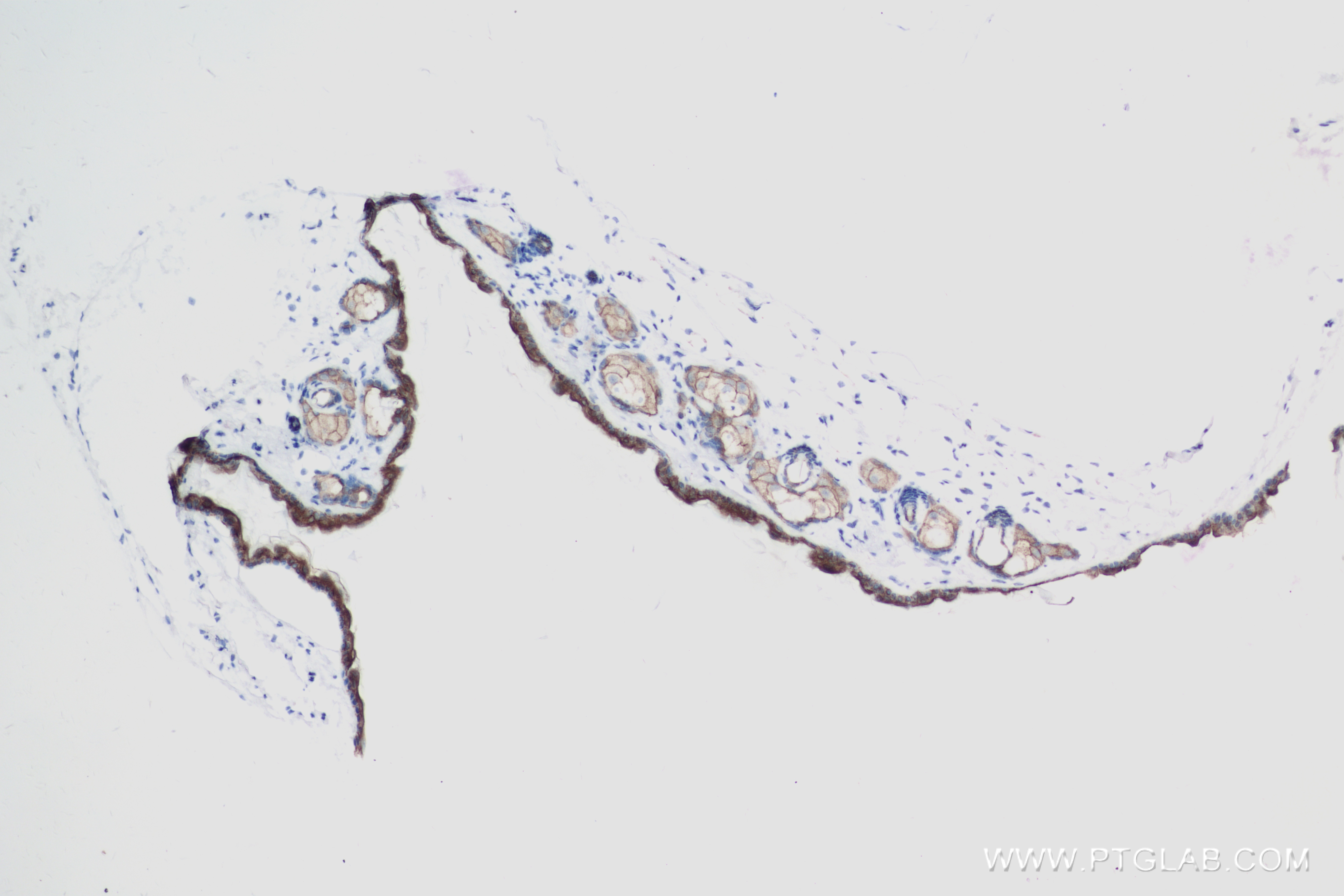 Immunohistochemistry (IHC) staining of mouse skin tissue using DSG1 Recombinant antibody (84053-6-RR)