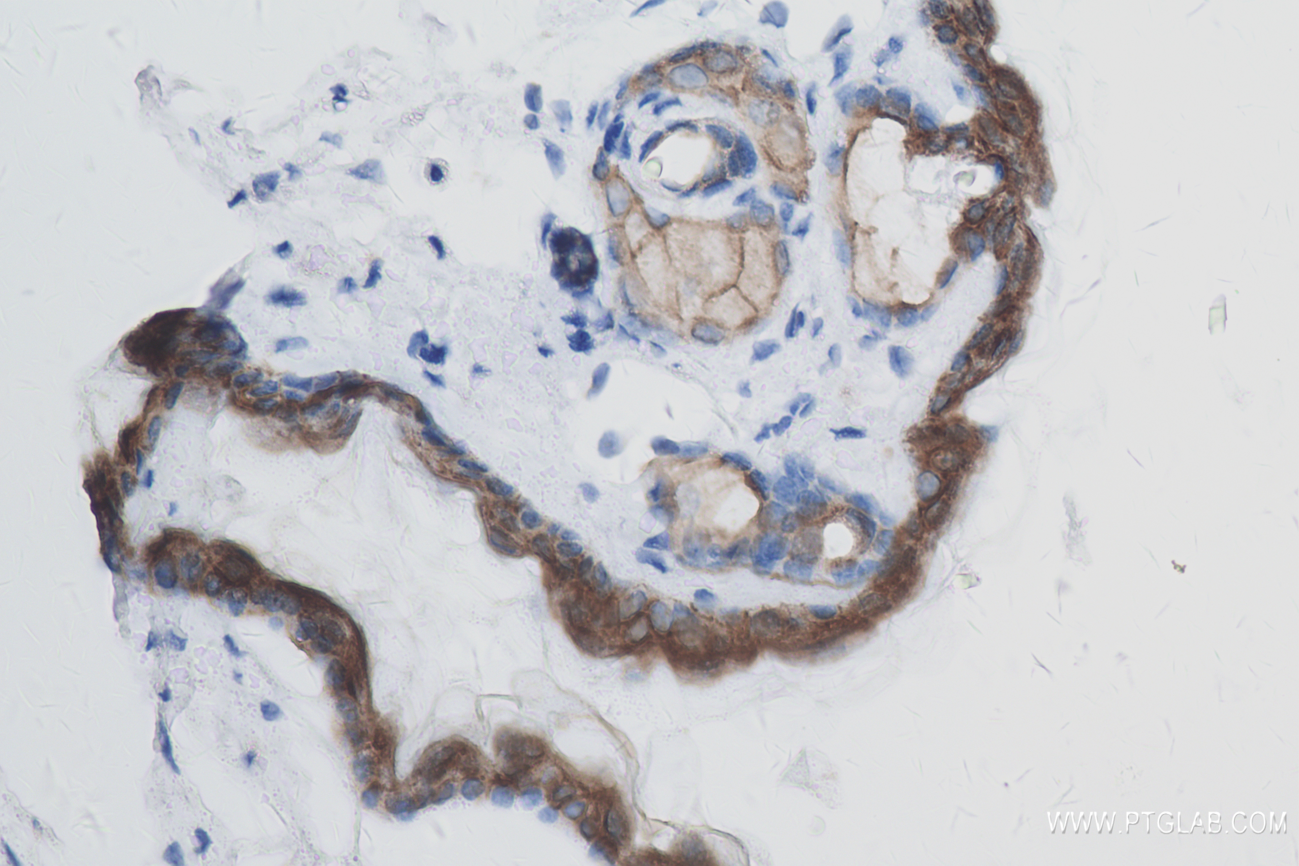 Immunohistochemistry (IHC) staining of mouse skin tissue using DSG1 Recombinant antibody (84053-6-RR)