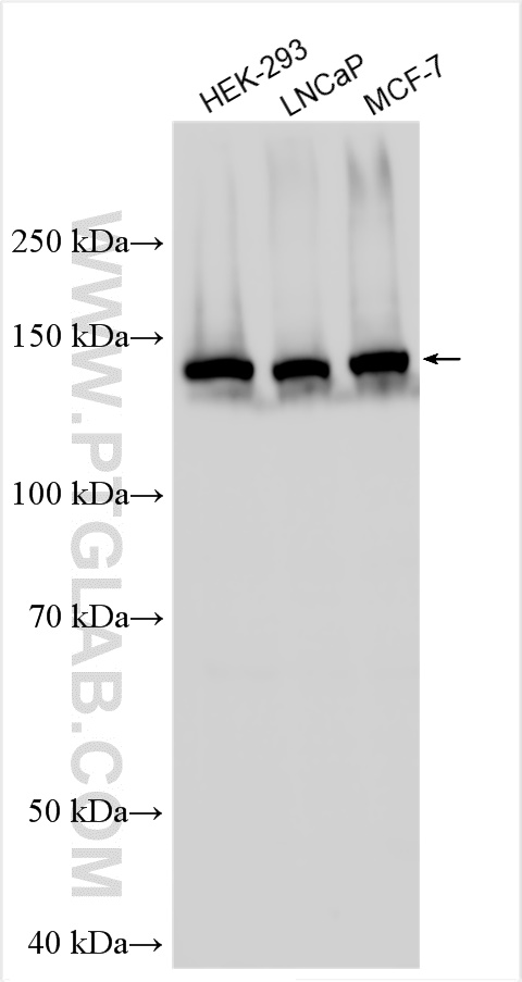 Western Blot (WB) analysis of various lysates using DSPP Polyclonal antibody (55396-1-AP)