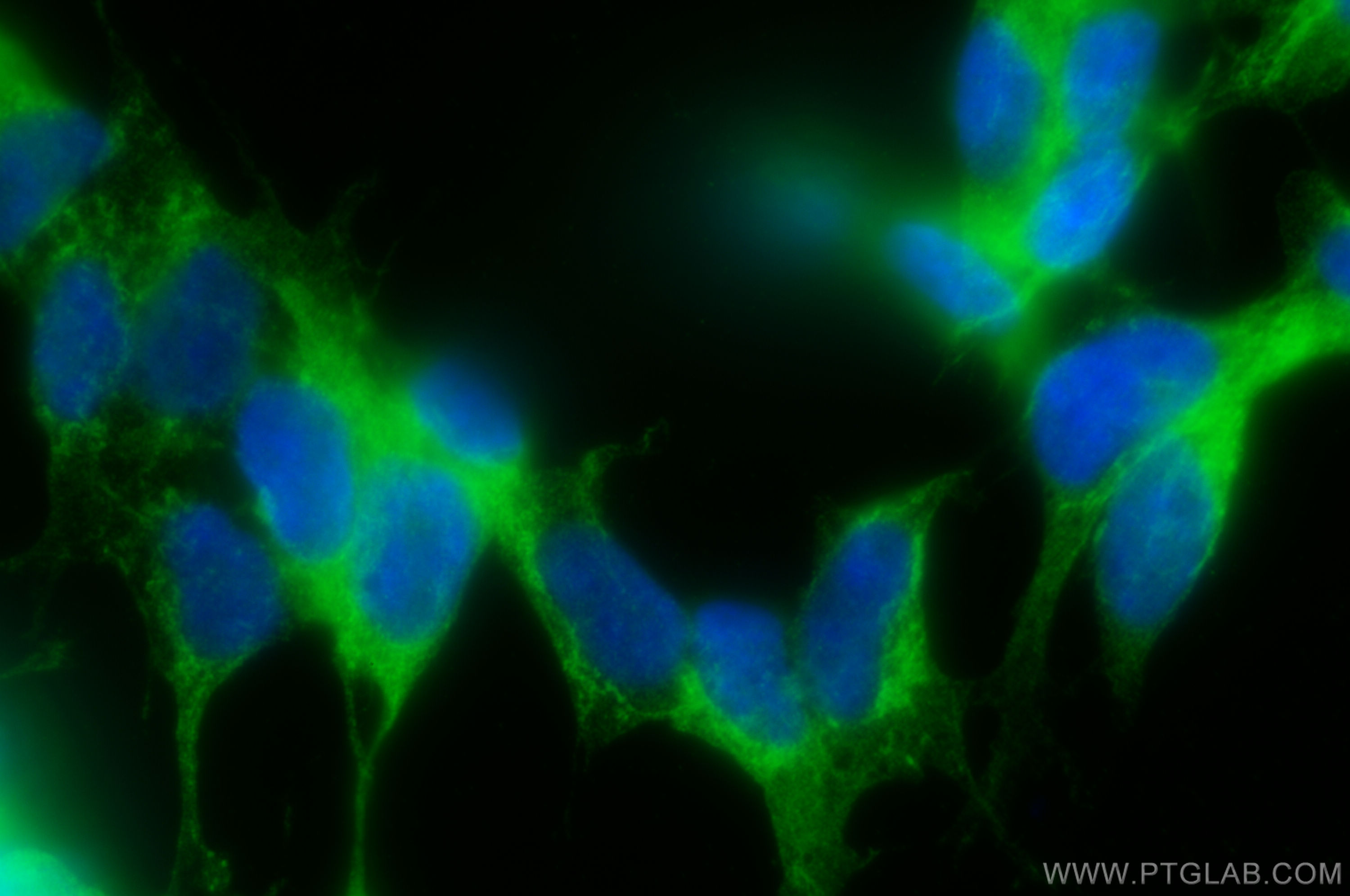 Immunofluorescence (IF) / fluorescent staining of SH-SY5Y cells using DST Polyclonal antibody (28438-1-AP)