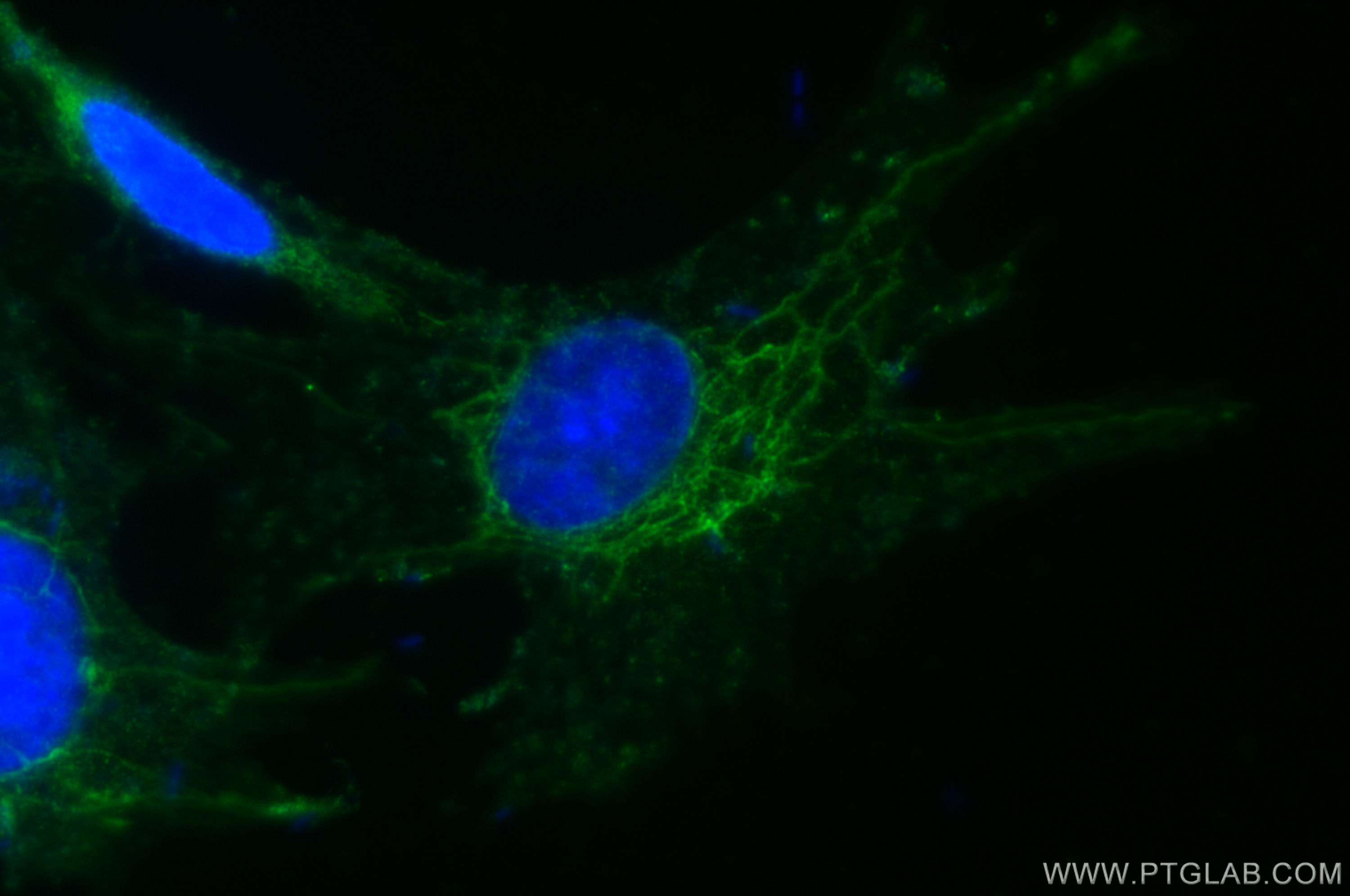 Immunofluorescence (IF) / fluorescent staining of SH-SY5Y cells using DST Polyclonal antibody (28438-1-AP)