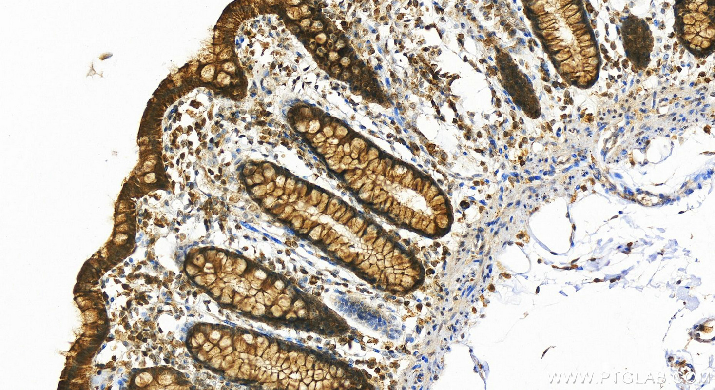 Immunohistochemistry (IHC) staining of human colon tissue using DTX1 Polyclonal antibody (18350-1-AP)