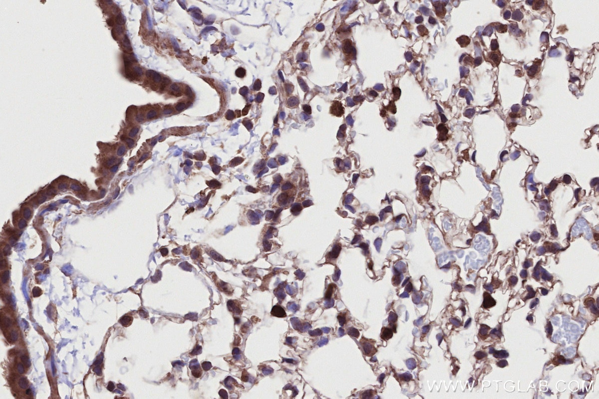 Immunohistochemistry (IHC) staining of mouse lung tissue using DTX3L Polyclonal antibody (11963-1-AP)