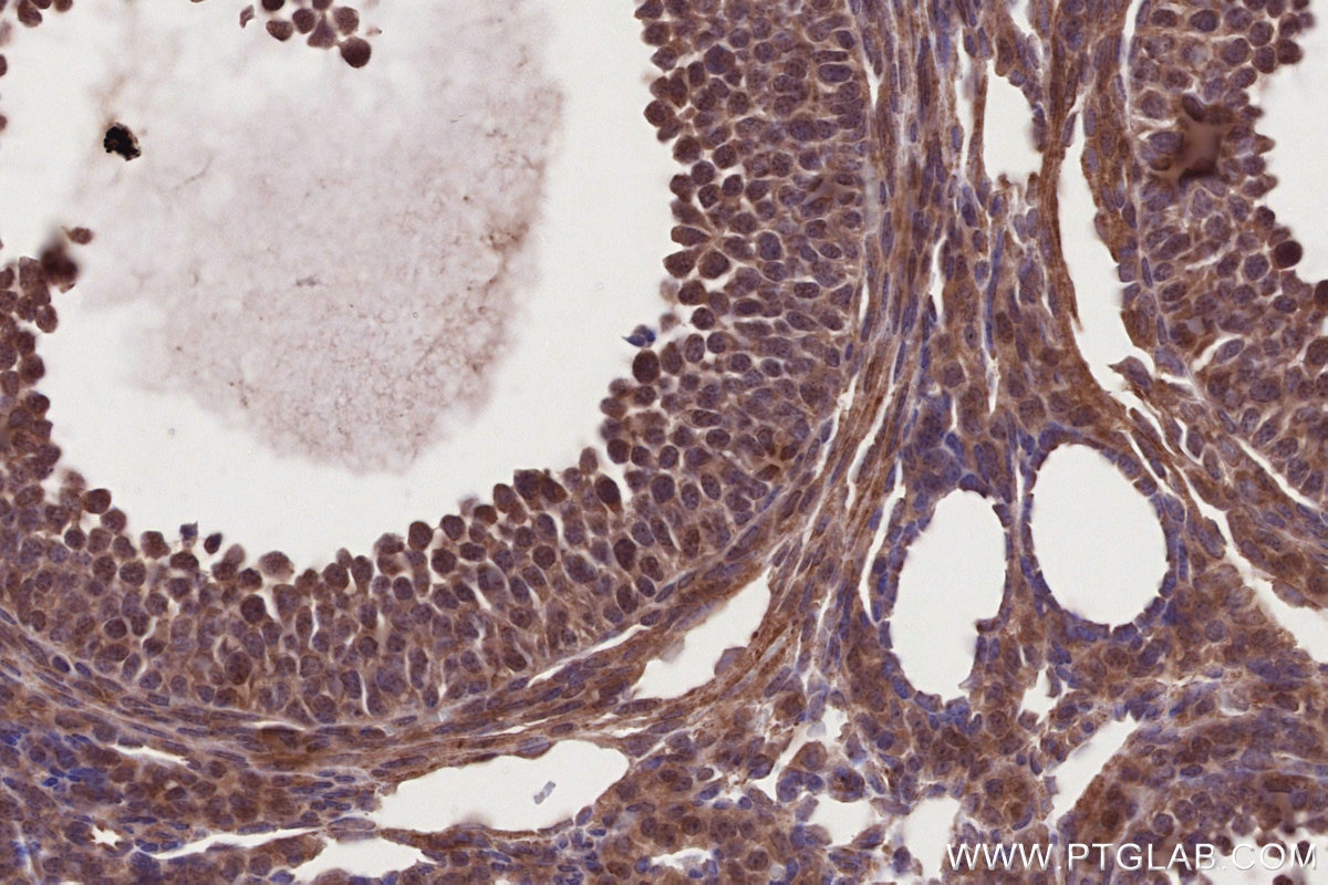 Immunohistochemistry (IHC) staining of mouse ovary tissue using DTX3L Polyclonal antibody (11963-1-AP)