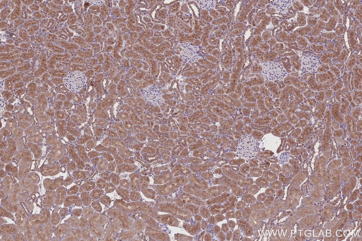 Immunohistochemistry (IHC) staining of rat kidney tissue using DTX3L Polyclonal antibody (11963-1-AP)