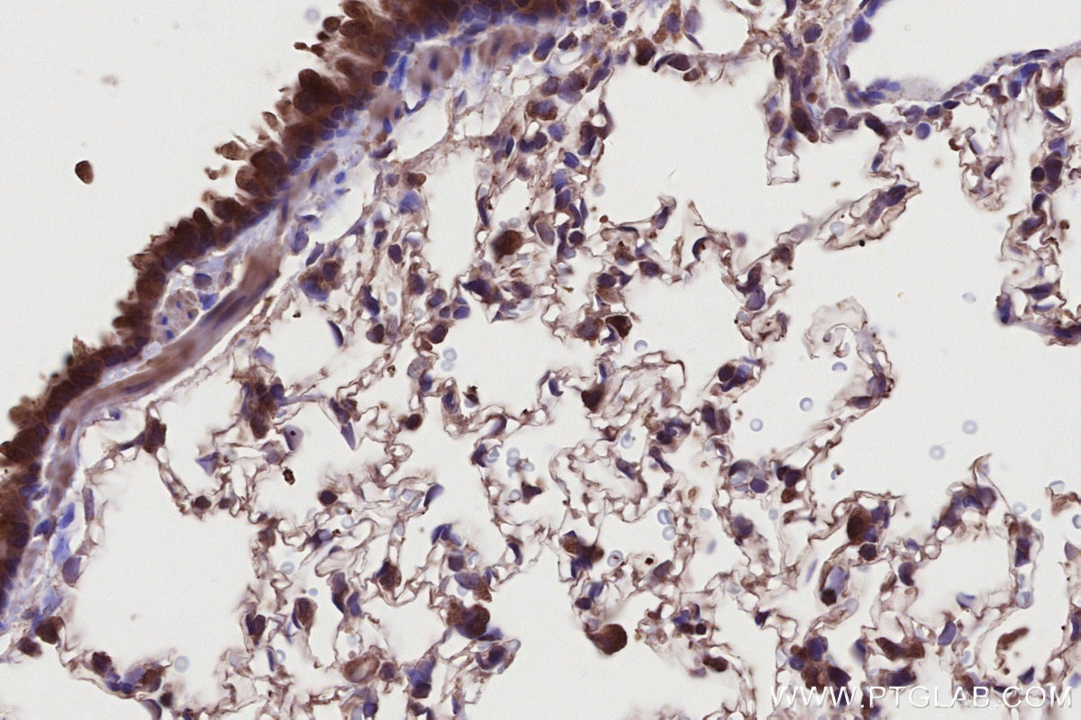 Immunohistochemistry (IHC) staining of rat lung tissue using DTX3L Polyclonal antibody (11963-1-AP)