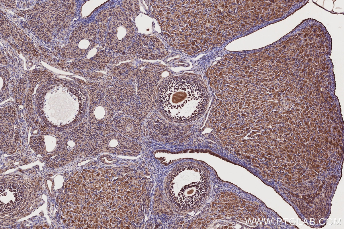 Immunohistochemistry (IHC) staining of rat ovary tissue using DTX3L Polyclonal antibody (11963-1-AP)