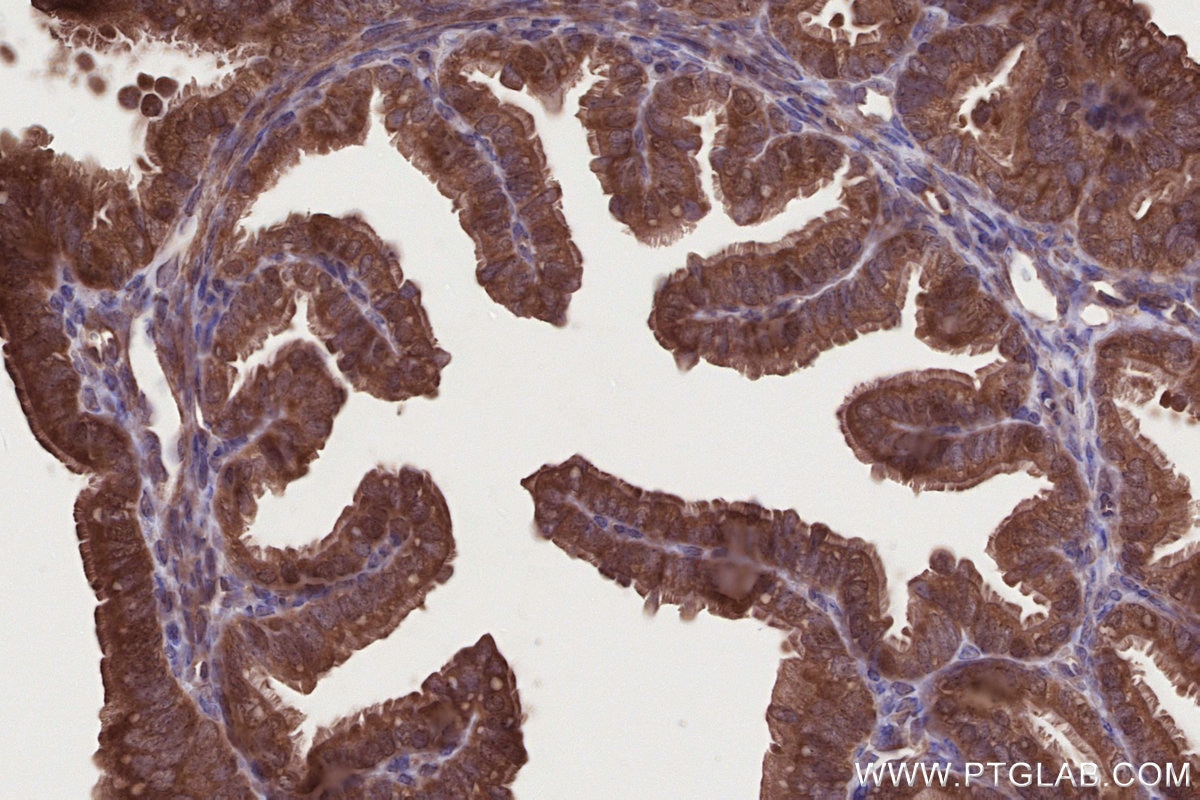 Immunohistochemistry (IHC) staining of mouse ovary tissue using DTX3L Polyclonal antibody (11963-1-AP)