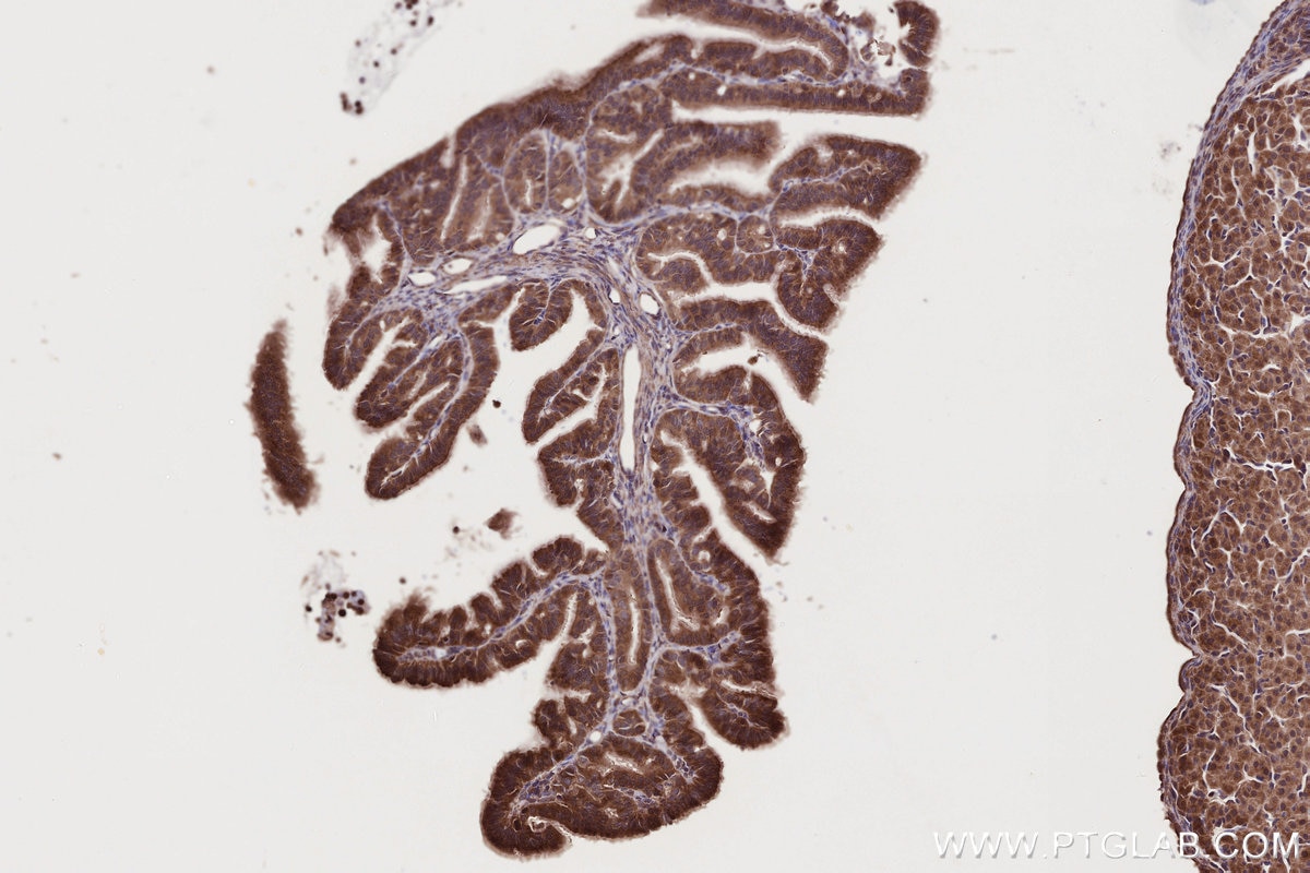 Immunohistochemistry (IHC) staining of rat ovary tissue using DTX3L Polyclonal antibody (11963-1-AP)