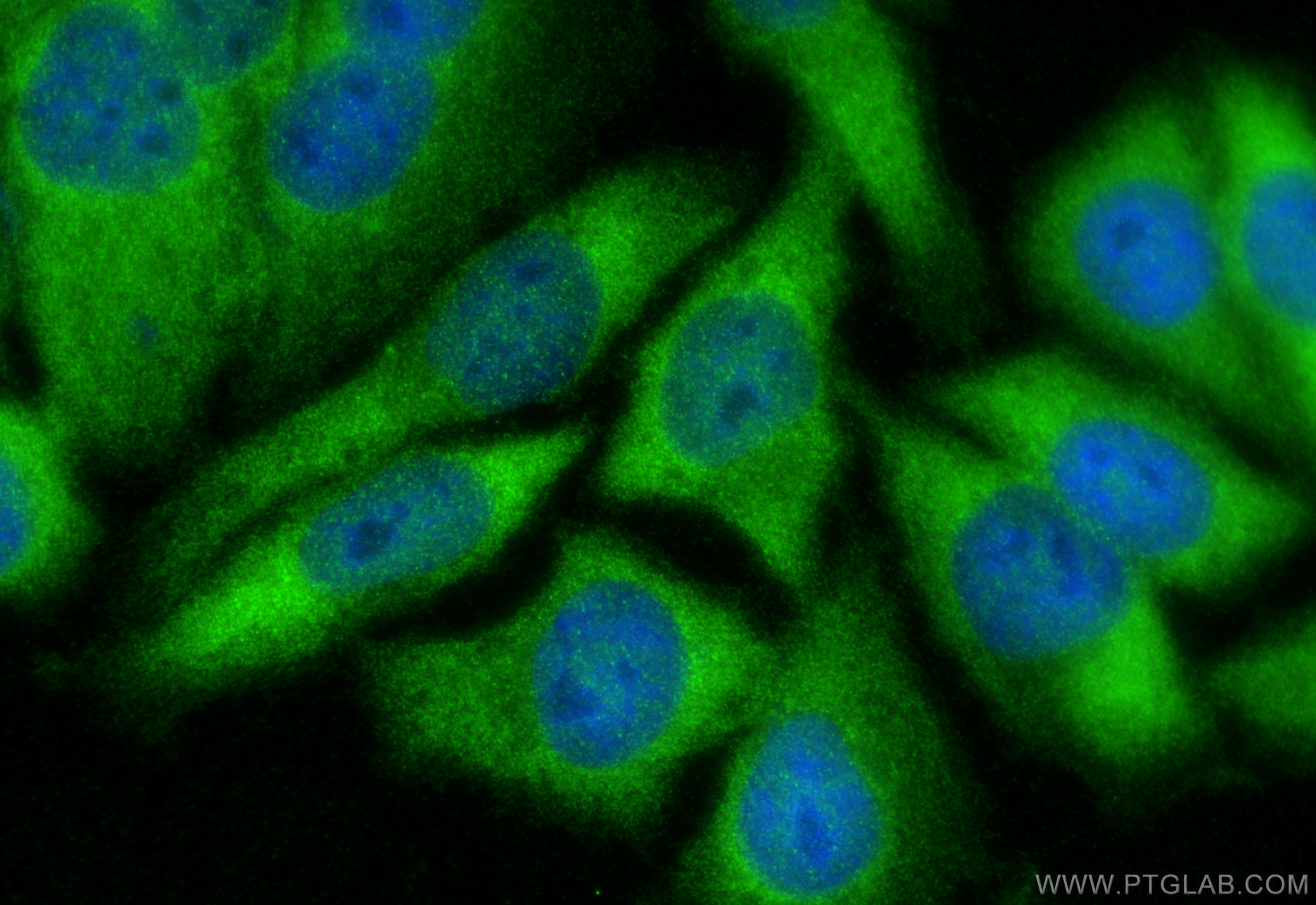 Immunofluorescence (IF) / fluorescent staining of HepG2 cells using DTYMK Polyclonal antibody (15360-1-AP)