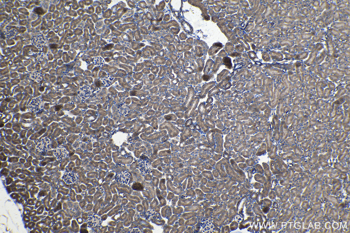 Immunohistochemistry (IHC) staining of mouse kidney tissue using DTYMK Polyclonal antibody (15360-1-AP)