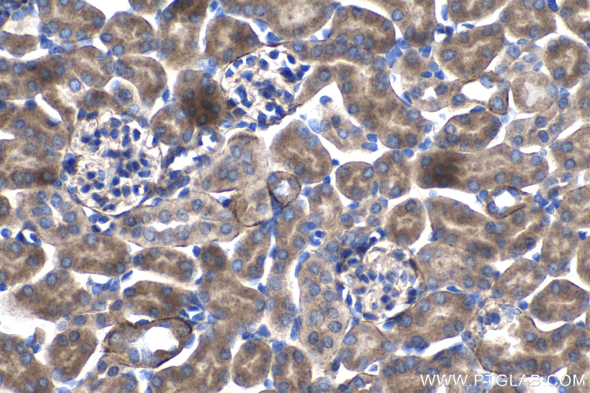 Immunohistochemistry (IHC) staining of mouse kidney tissue using DTYMK Polyclonal antibody (15360-1-AP)