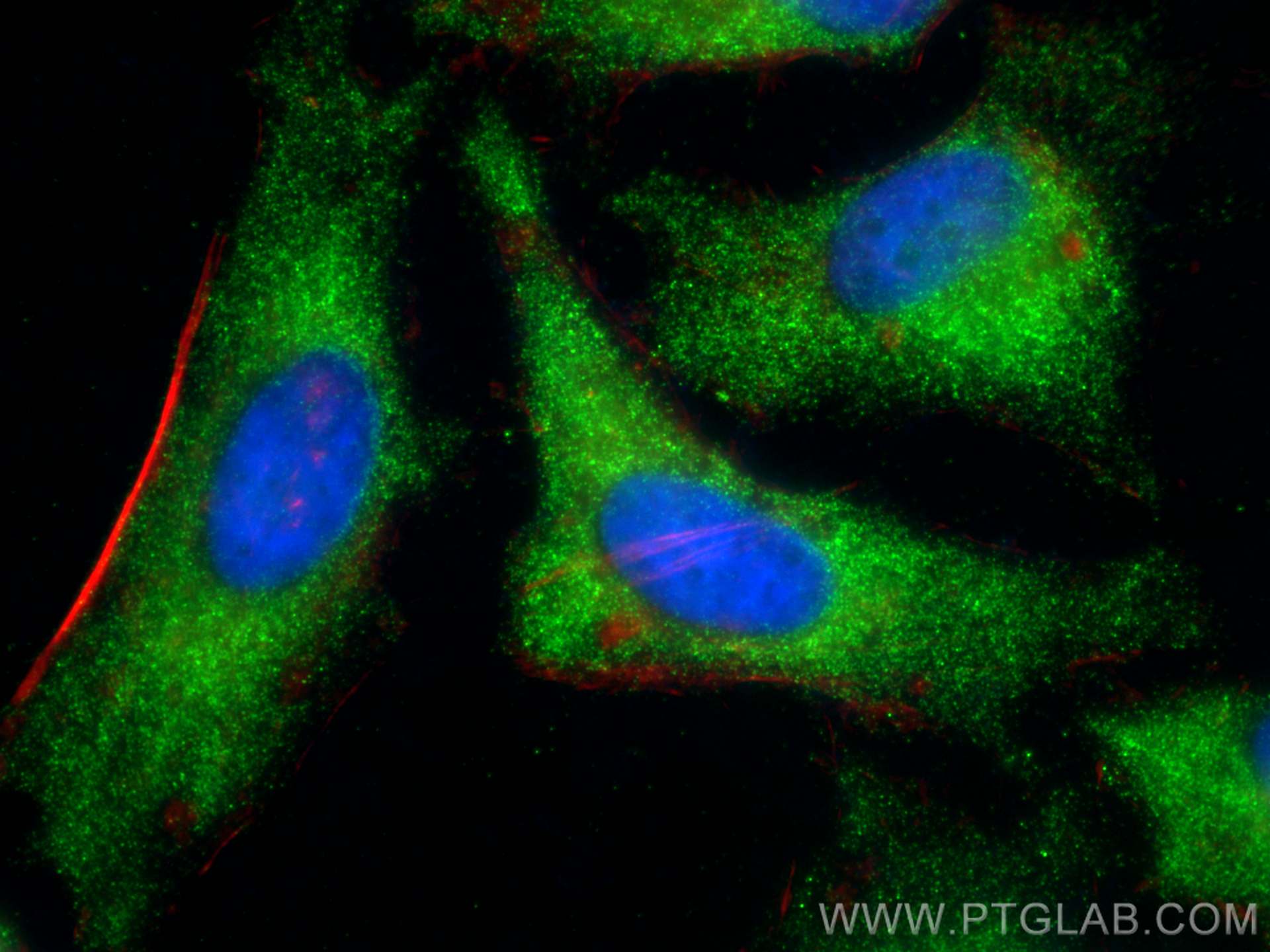 Immunofluorescence (IF) / fluorescent staining of HeLa cells using DUSP6 Polyclonal antibody (26071-1-AP)
