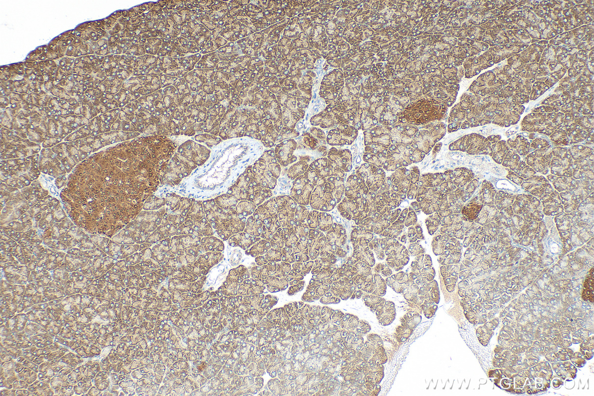 Immunohistochemistry (IHC) staining of mouse pancreas tissue using DUSP6 Polyclonal antibody (26071-1-AP)