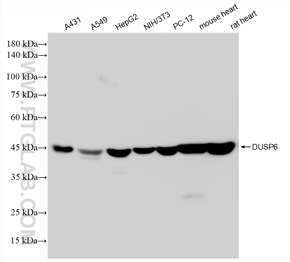 Western Blot (WB) analysis of various lysates using DUSP6 Recombinant antibody (83356-5-RR)