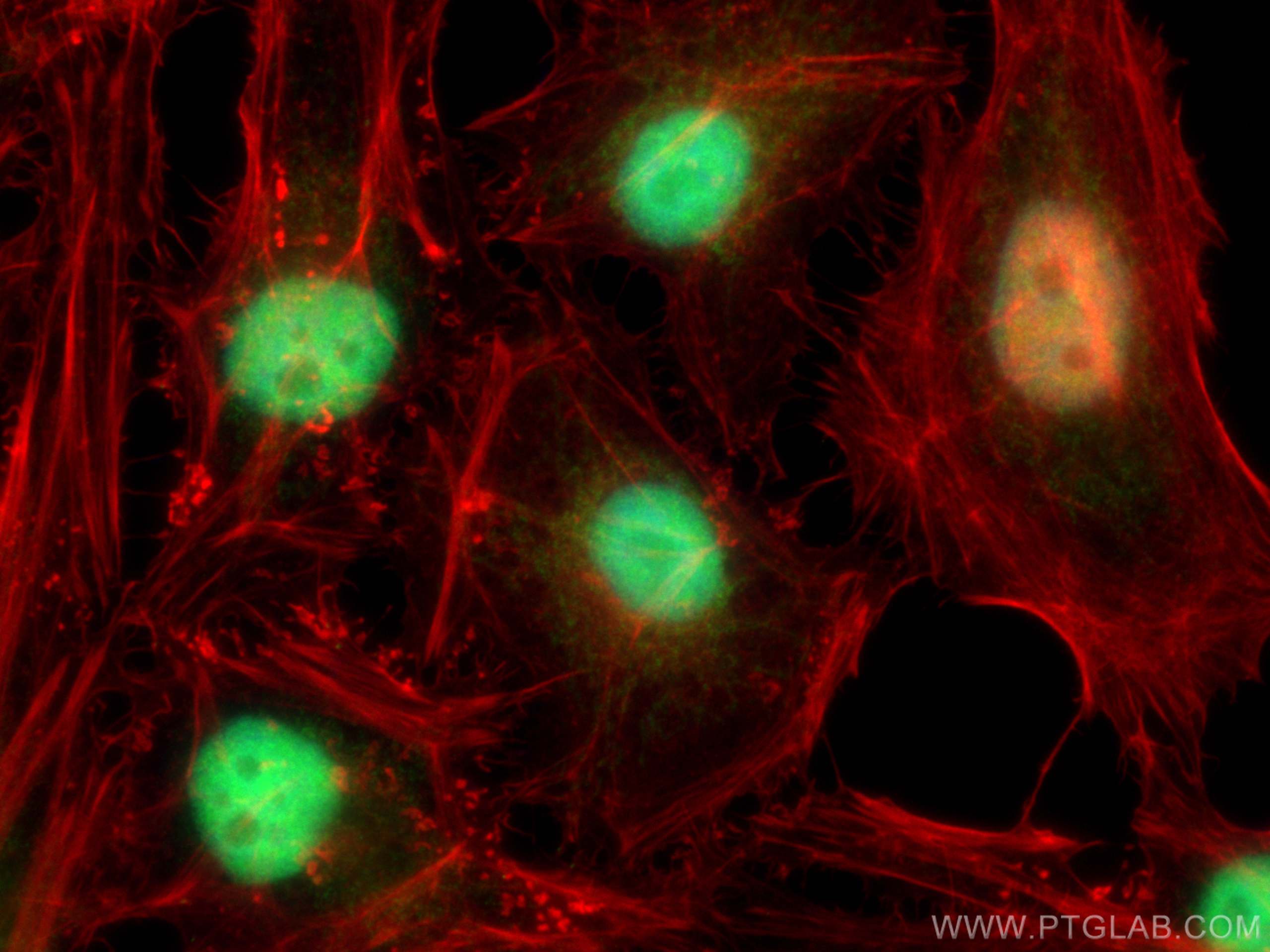 Immunofluorescence (IF) / fluorescent staining of HeLa cells using DUT Polyclonal antibody (13740-1-AP)