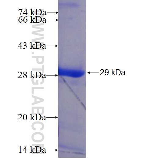 DYDC2 fusion protein Ag22443 SDS-PAGE