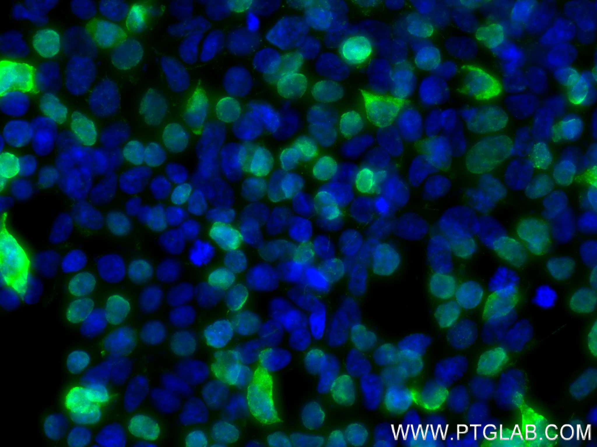 Immunofluorescence (IF) / fluorescent staining of Transfected HEK-293T cells using DYKDDDDK tag Recombinant antibody (Binds to FLAG®  (80801-2-RR)