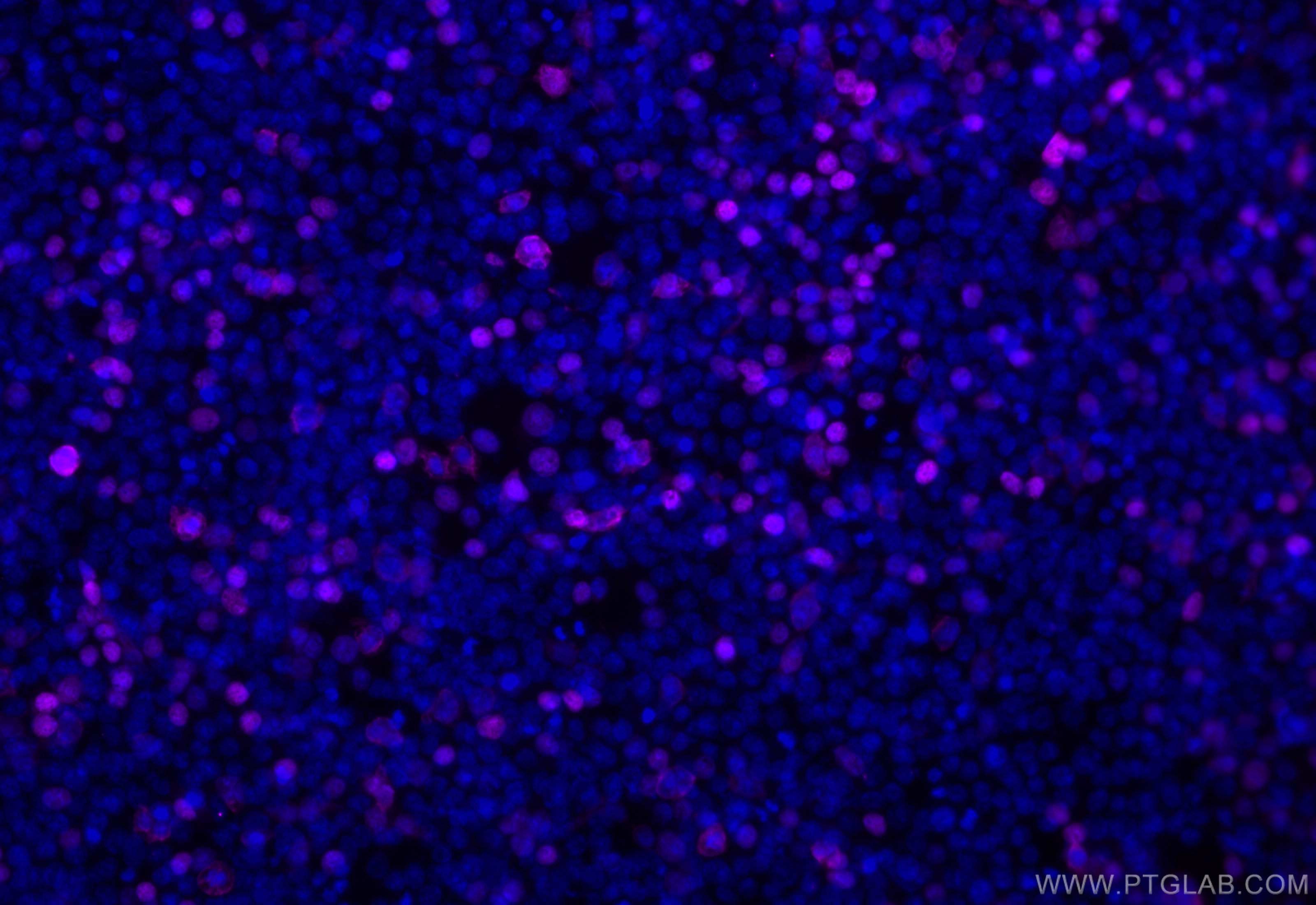 Immunofluorescence (IF) / fluorescent staining of Transfected HEK-293 cells using CoraLite® Plus 647-conjugated DYKDDDDK tag Recombi (CL647-80801-2)