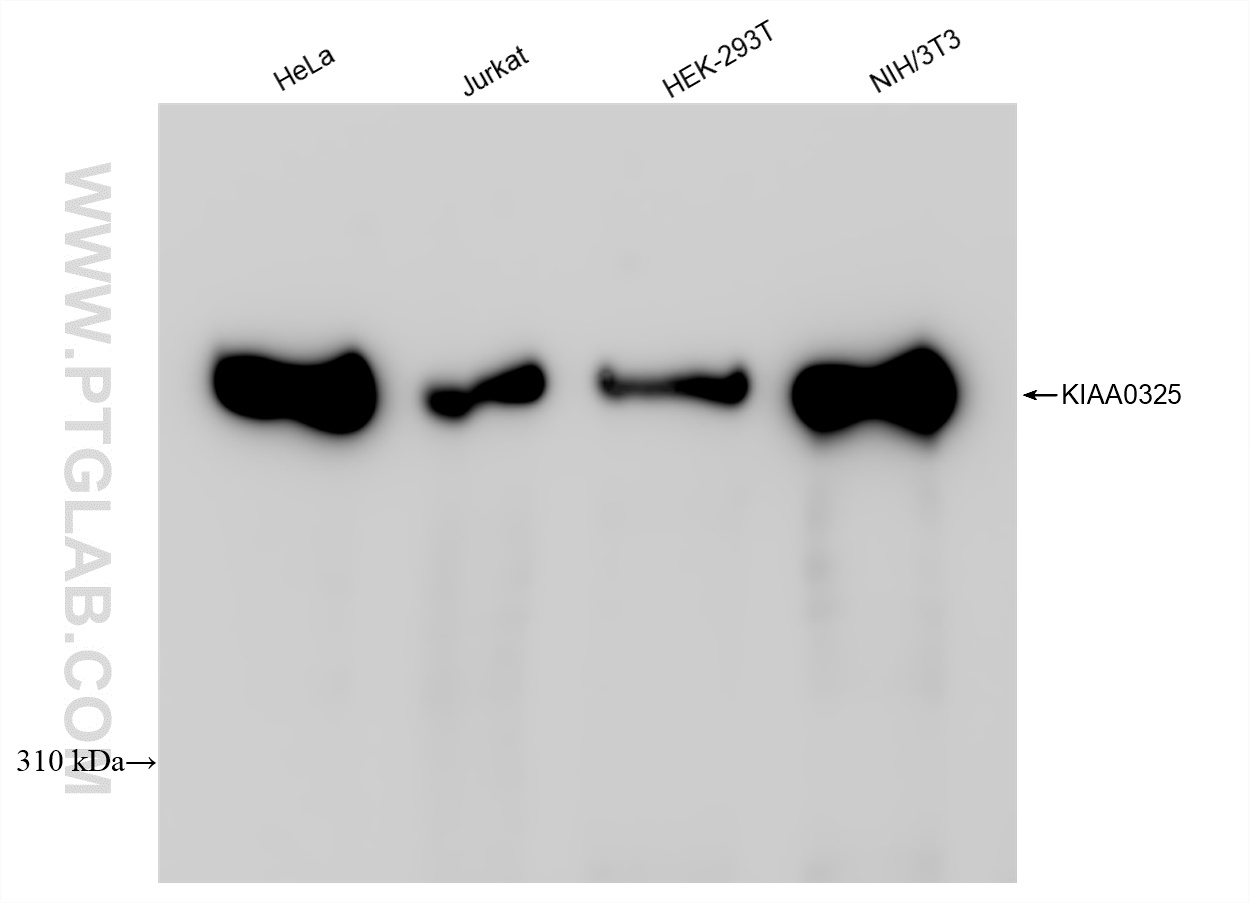 Western Blot (WB) analysis of various lysates using DYNC1H1 Recombinant antibody (85397-4-RR)
