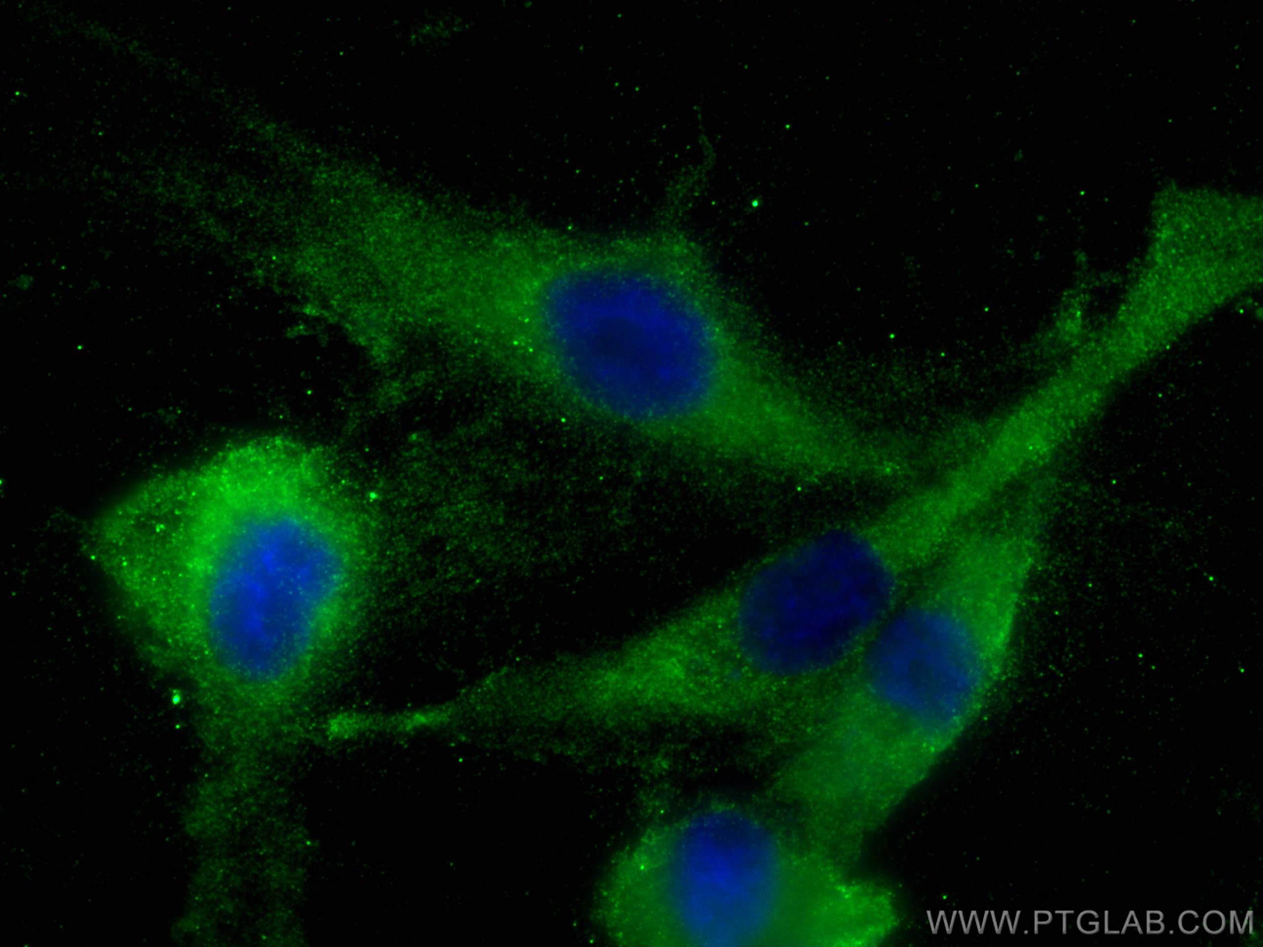 Immunofluorescence (IF) / fluorescent staining of HUVEC cells using DYNC1I1 Polyclonal antibody (13808-1-AP)