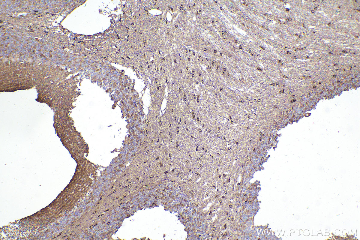 Immunohistochemistry (IHC) staining of mouse cerebellum tissue using DYNC1I2 Polyclonal antibody (12219-1-AP)