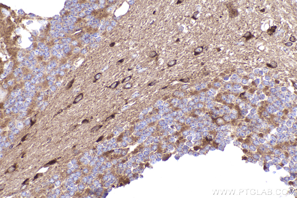 Immunohistochemistry (IHC) staining of mouse cerebellum tissue using DYNC1I2 Polyclonal antibody (12219-1-AP)