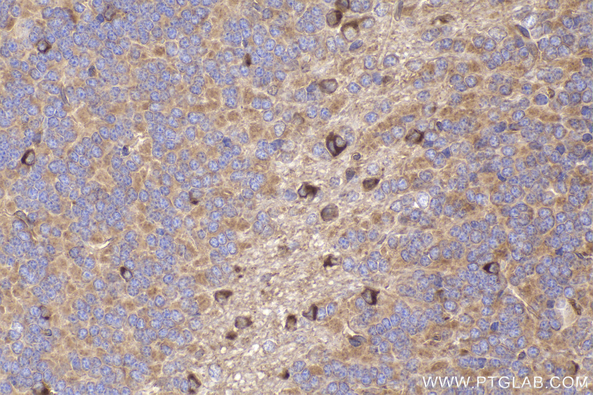 Immunohistochemistry (IHC) staining of rat cerebellum tissue using DYNC1I2 Polyclonal antibody (12219-1-AP)