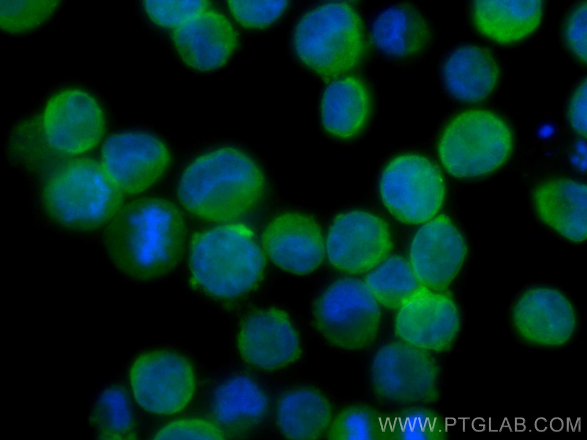 Immunofluorescence (IF) / fluorescent staining of K-562 cells using DYNC1LI1 Polyclonal antibody (25326-1-AP)