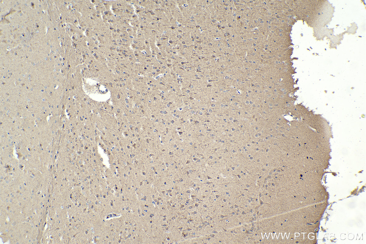 Immunohistochemistry (IHC) staining of mouse brain tissue using DYNC1LI2 Polyclonal antibody (18885-1-AP)