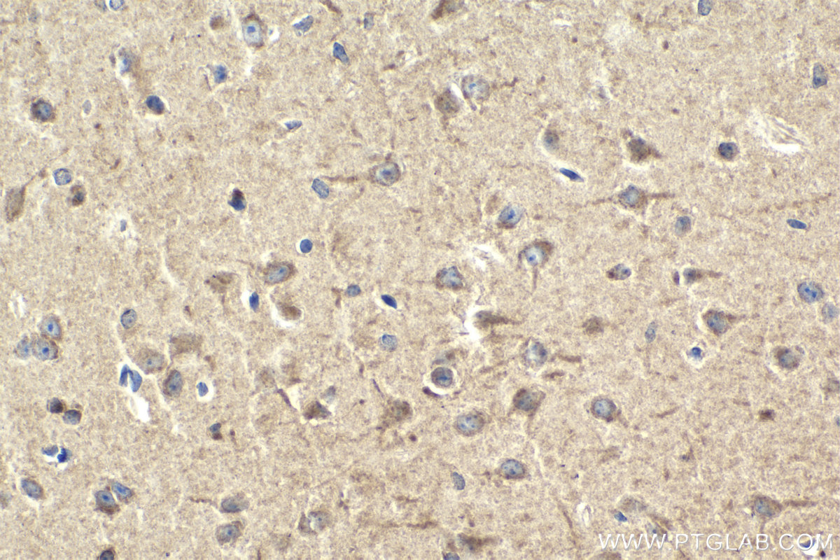 Immunohistochemistry (IHC) staining of mouse brain tissue using DYNC1LI2 Polyclonal antibody (18885-1-AP)