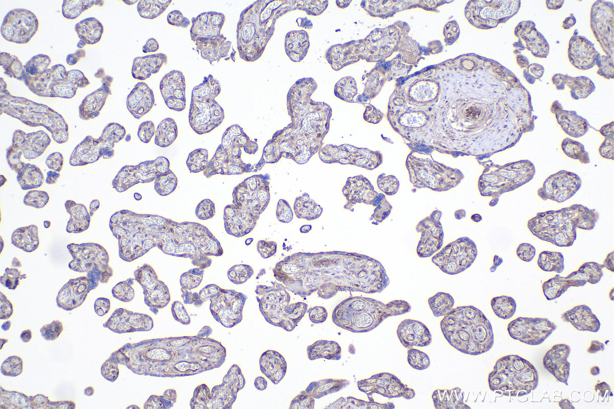 Immunohistochemistry (IHC) staining of human placenta tissue using DYNC1LI2 Polyclonal antibody (18885-1-AP)