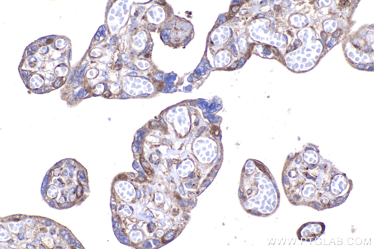 Immunohistochemistry (IHC) staining of human placenta tissue using DYNC1LI2 Polyclonal antibody (18885-1-AP)