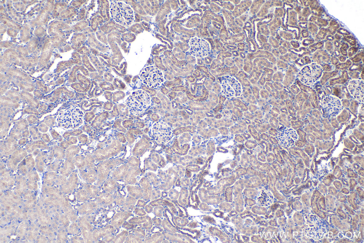 Immunohistochemistry (IHC) staining of rat kidney tissue using DYNC1LI2 Polyclonal antibody (18885-1-AP)