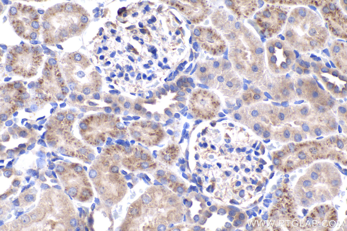 Immunohistochemistry (IHC) staining of rat kidney tissue using DYNC1LI2 Polyclonal antibody (18885-1-AP)