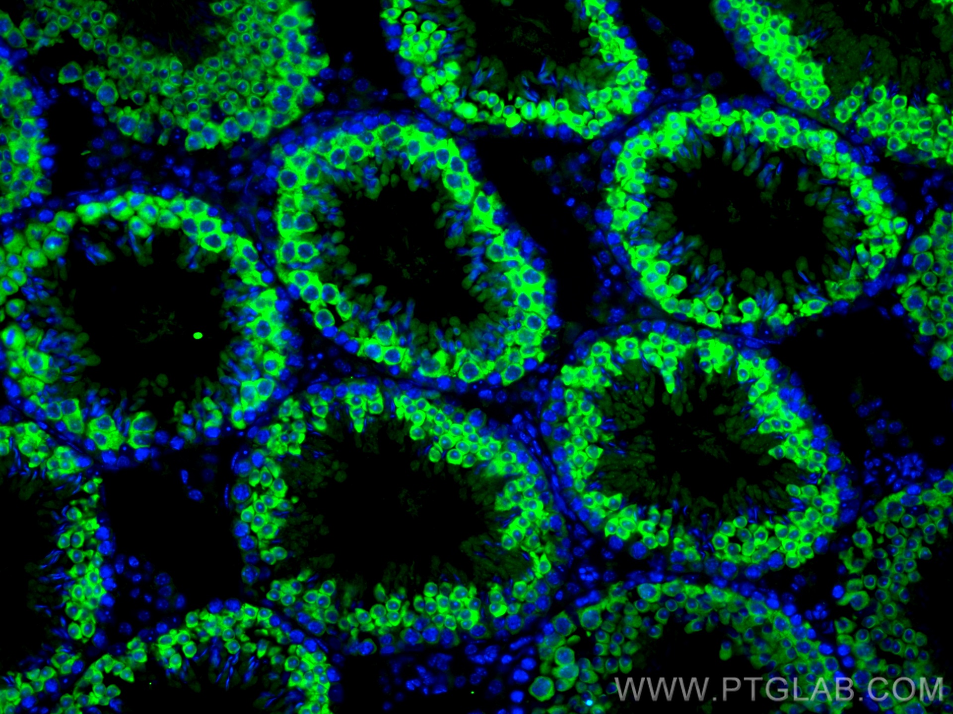 Immunofluorescence (IF) / fluorescent staining of mouse testis tissue using DYNLT1 Polyclonal antibody (11954-1-AP)