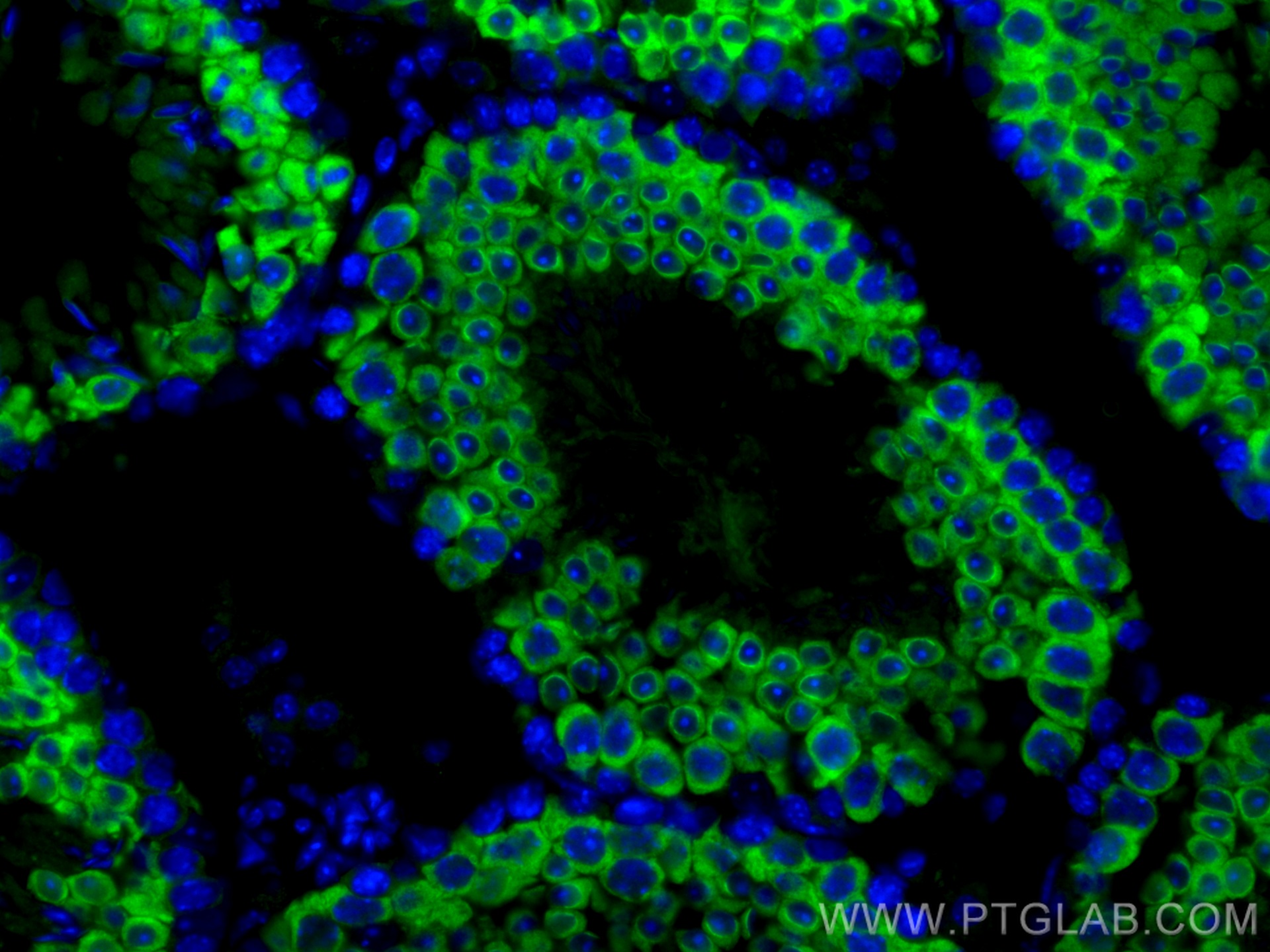 Immunofluorescence (IF) / fluorescent staining of mouse testis tissue using DYNLT1 Polyclonal antibody (11954-1-AP)