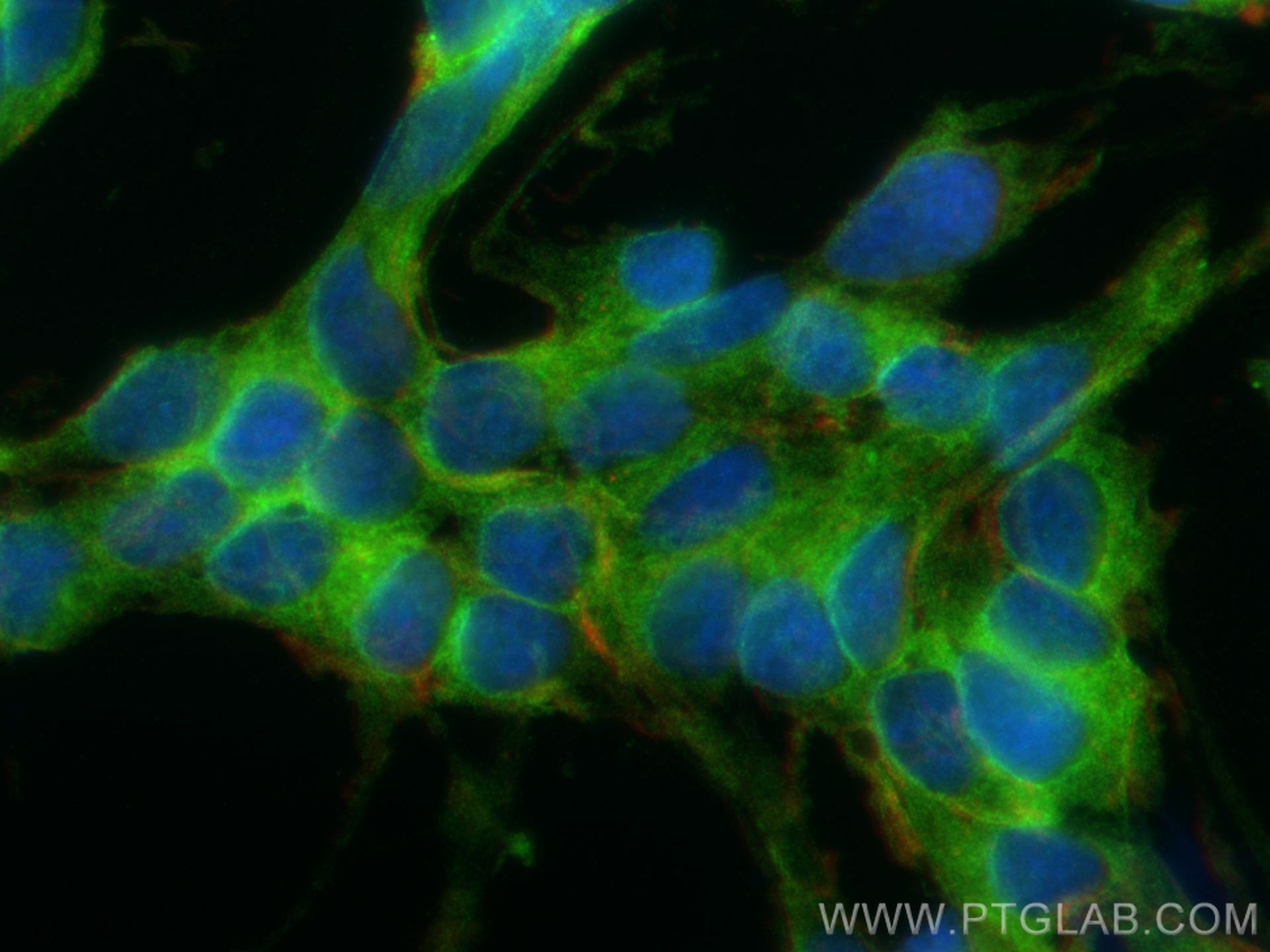 Immunofluorescence (IF) / fluorescent staining of SH-SY5Y cells using DYNLT1 Polyclonal antibody (11954-1-AP)