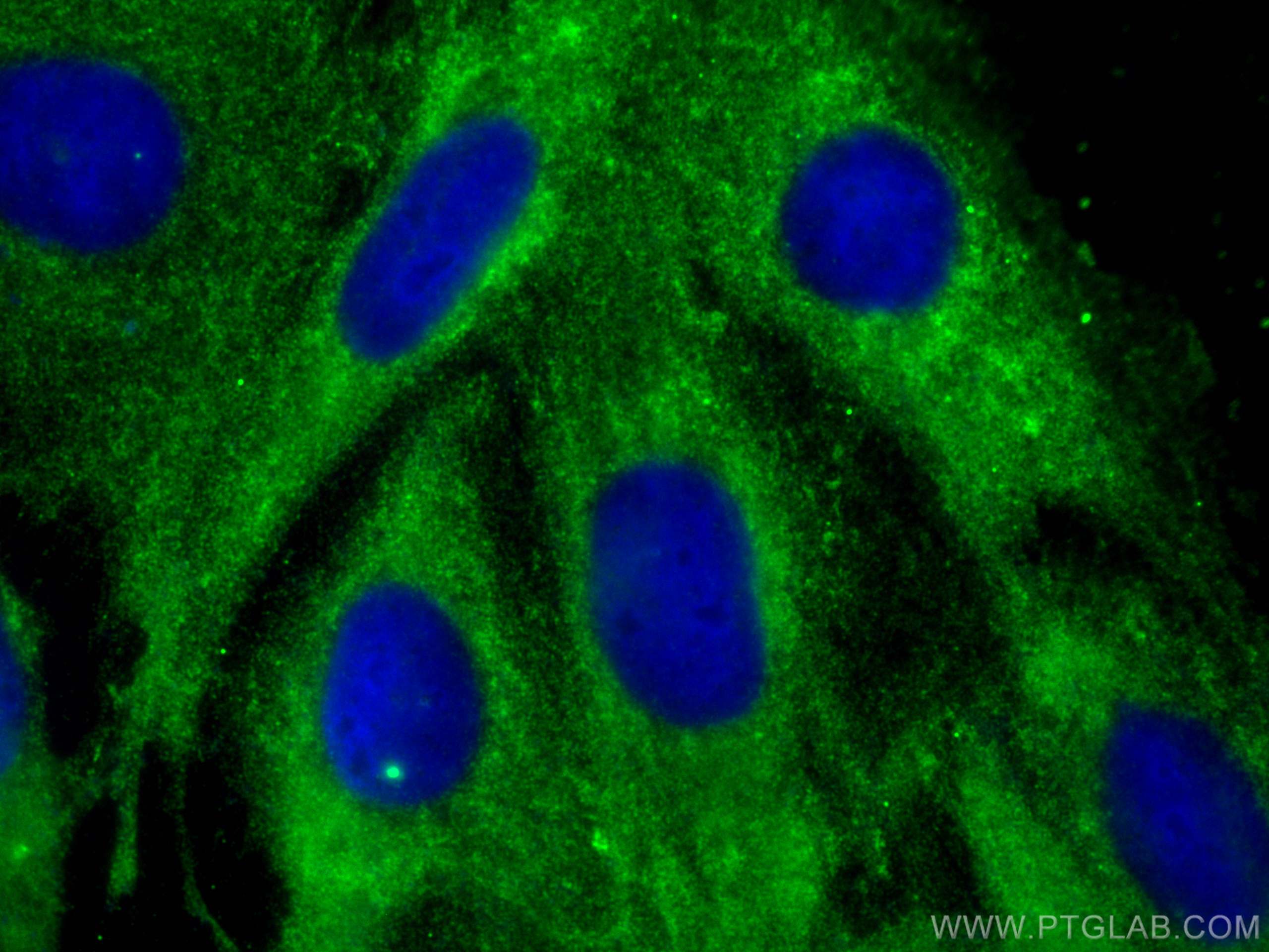 Immunofluorescence (IF) / fluorescent staining of H9C2 cells using DYNLT1 Monoclonal antibody (68312-1-Ig)