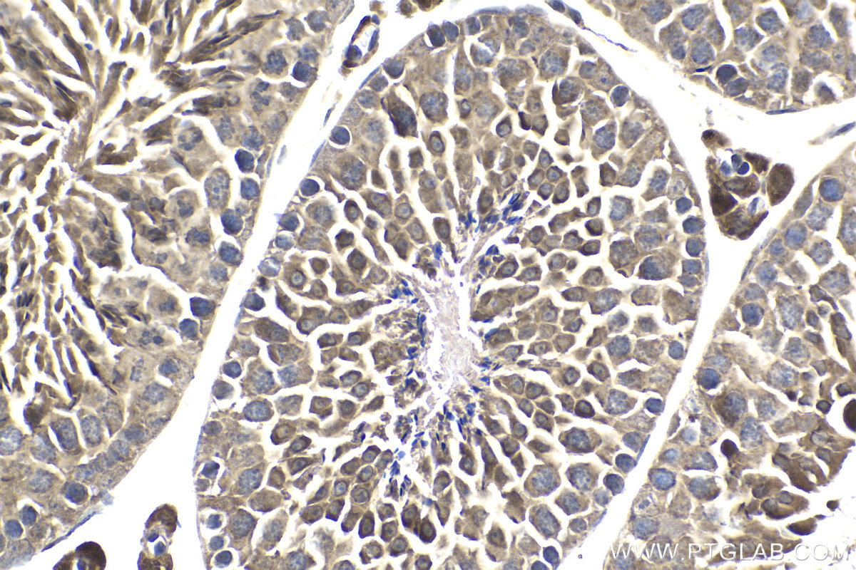 Immunohistochemistry (IHC) staining of mouse testis tissue using DZIP1 Polyclonal antibody (13779-1-AP)