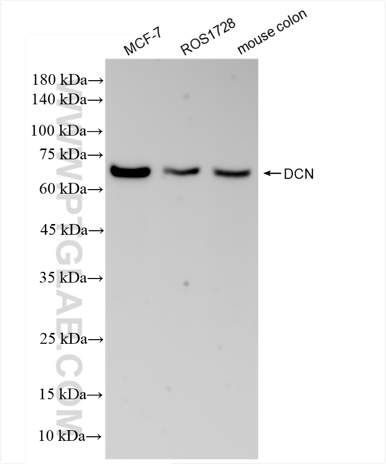 Western Blot (WB) analysis of various lysates using Decorin Recombinant antibody (83753-4-RR)