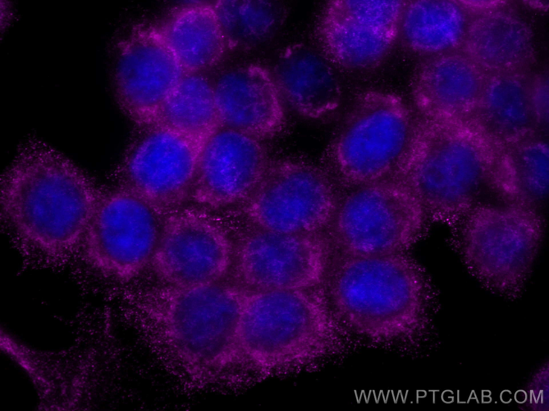 Immunofluorescence (IF) / fluorescent staining of BxPC-3 cells using CoraLite® Plus 647-conjugated Decorin Monoclonal a (CL647-66847)