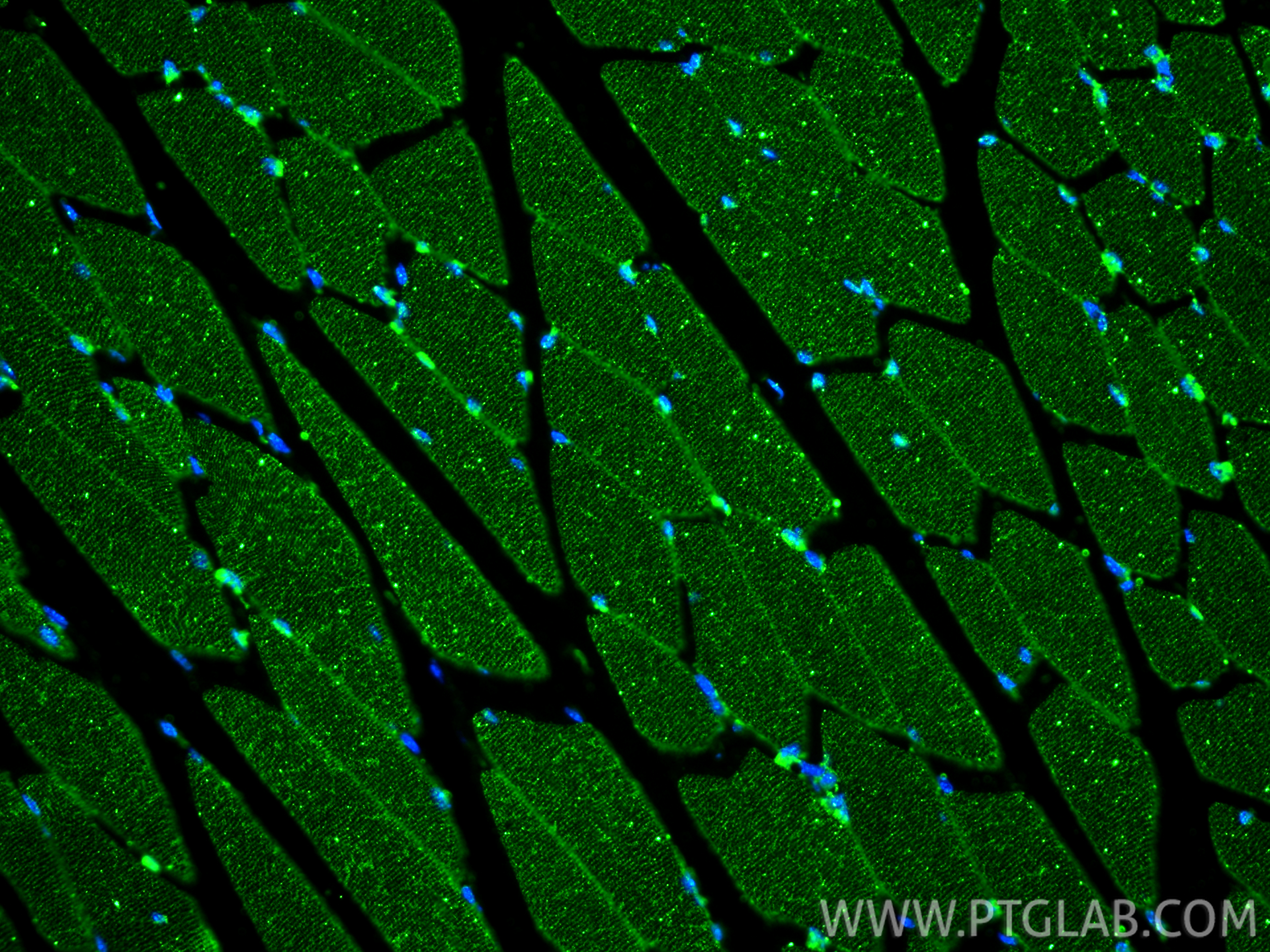 Immunofluorescence (IF) / fluorescent staining of mouse skeletal muscle tissue using Desmin Monoclonal antibody (67793-1-Ig)