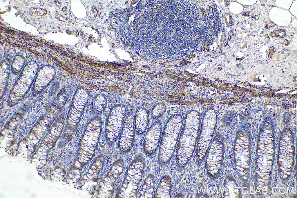 Immunohistochemistry (IHC) staining of human colon tissue using Desmin Monoclonal antibody (67793-1-Ig)