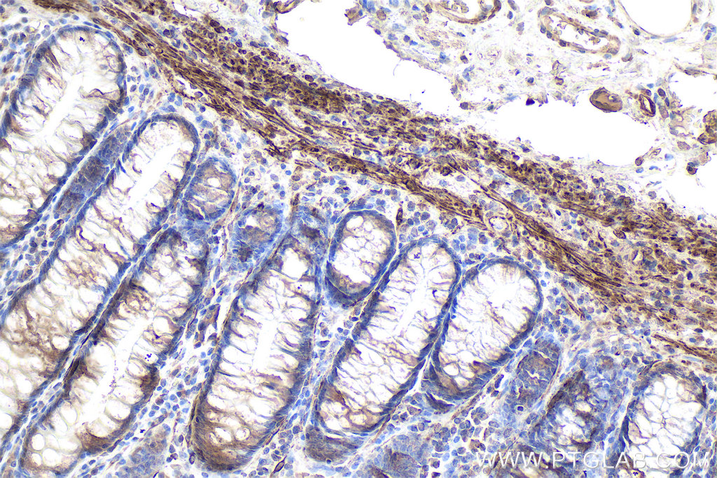 Immunohistochemistry (IHC) staining of human colon tissue using Desmin Monoclonal antibody (67793-1-Ig)