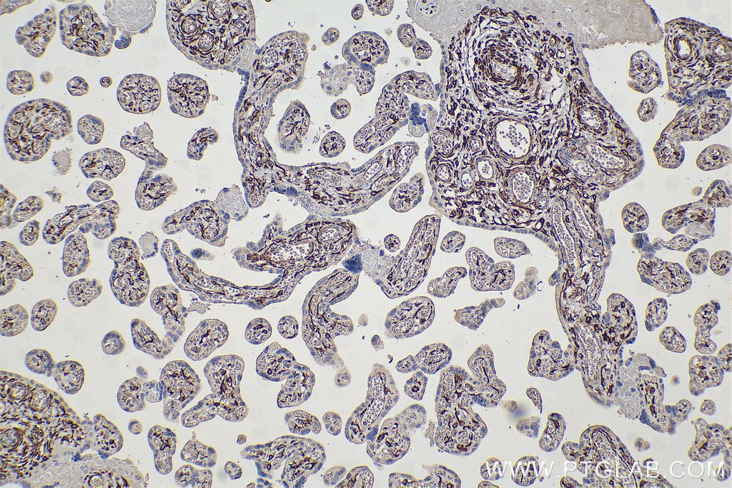 Immunohistochemistry (IHC) staining of human placenta tissue using Desmin Monoclonal antibody (67793-1-Ig)